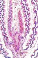 Bourgeon de Tilleul CL x5